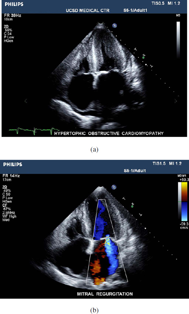 Fig. 42