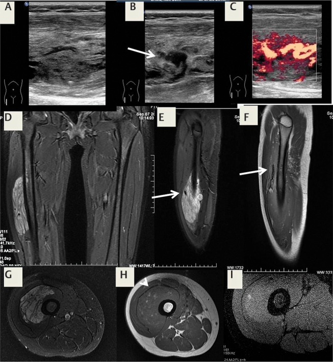 Fig. 23