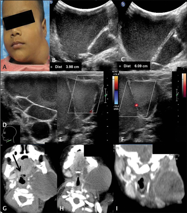 Fig. 18