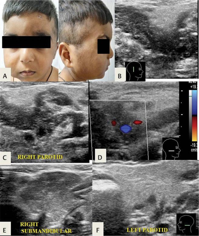 Fig. 24