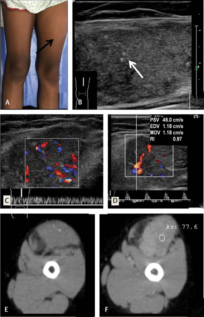 Fig. 14