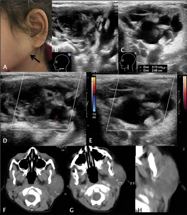 Fig. 20