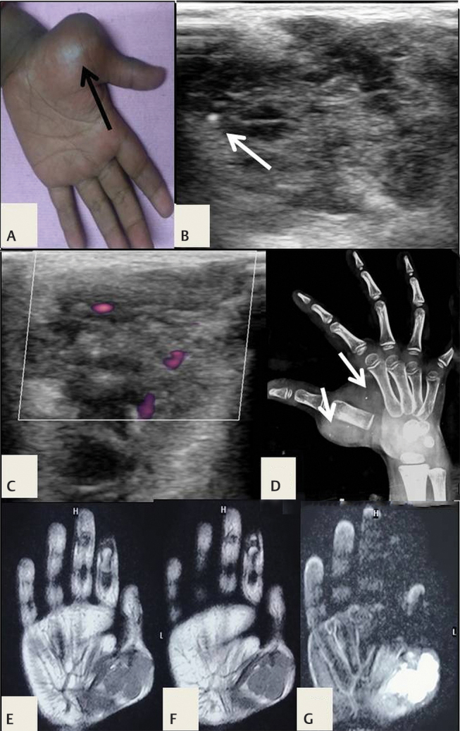 Fig. 15