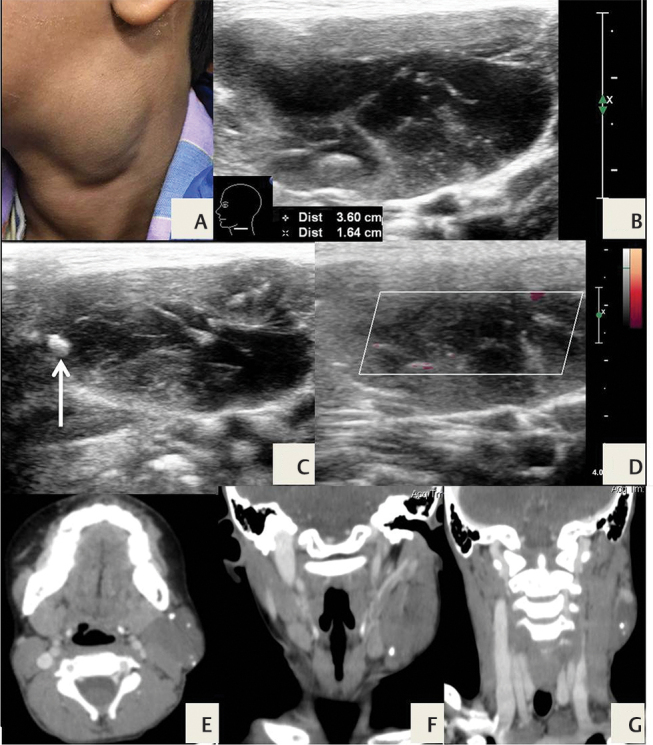 Fig. 12