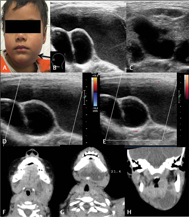 Fig. 19