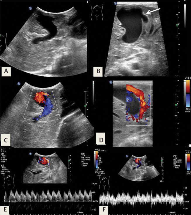 Fig. 10