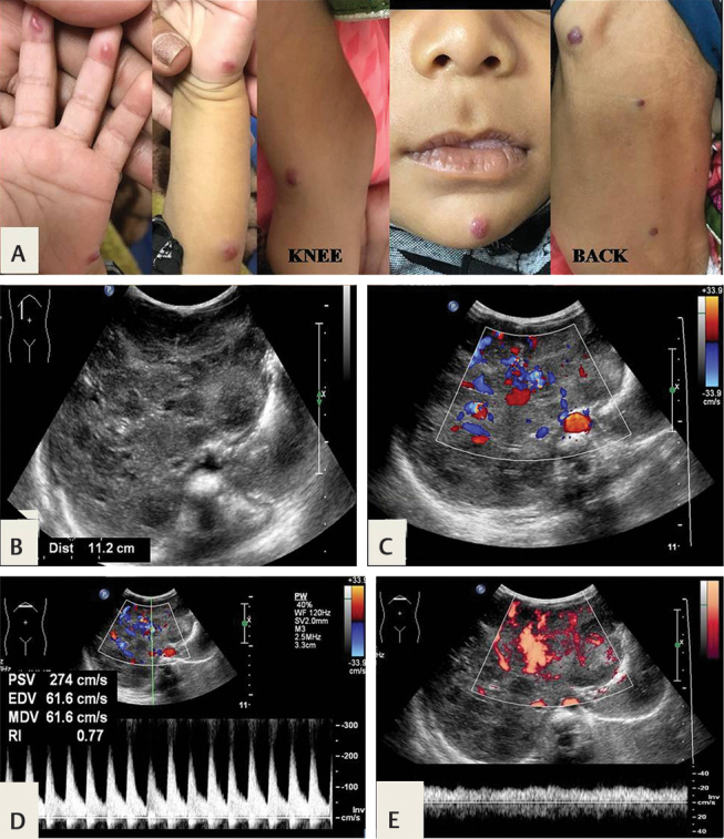 Fig. 4