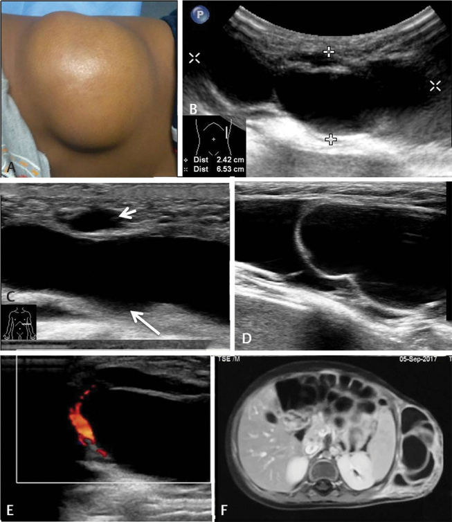 Fig. 16