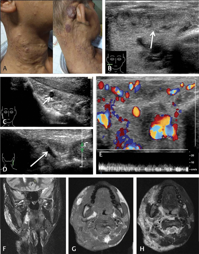 Fig. 13