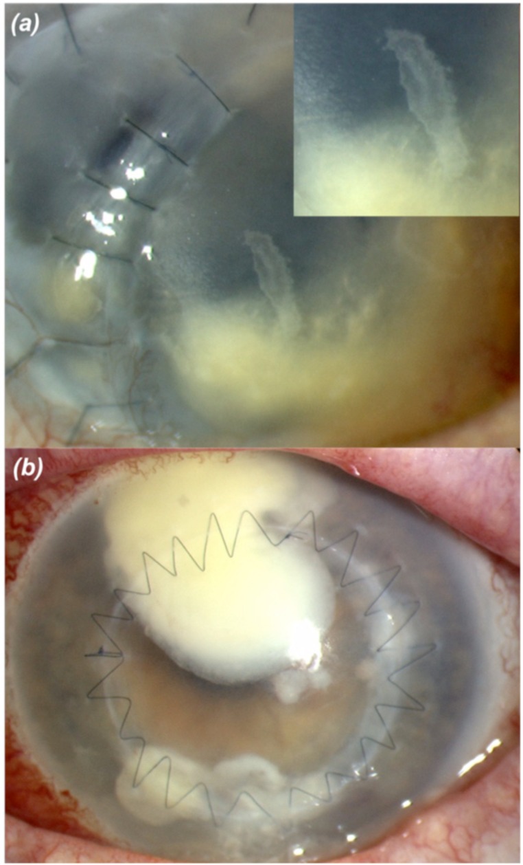 Fig. (2)