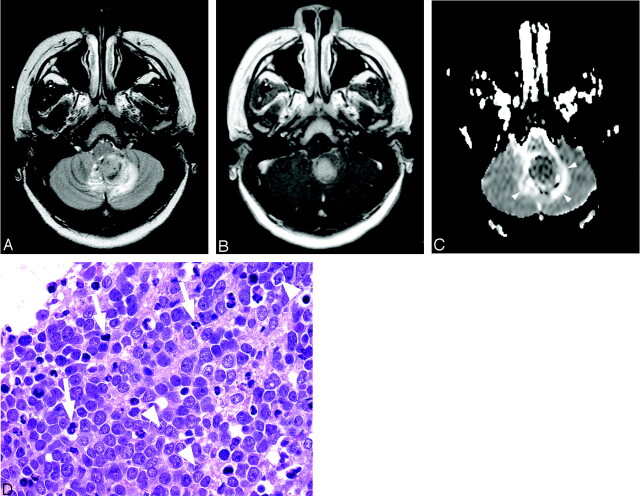 Fig 3.