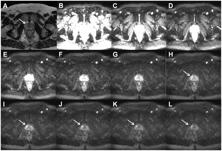 Fig. 10.