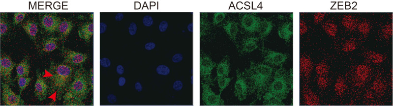 Figure 7—figure supplement 3.