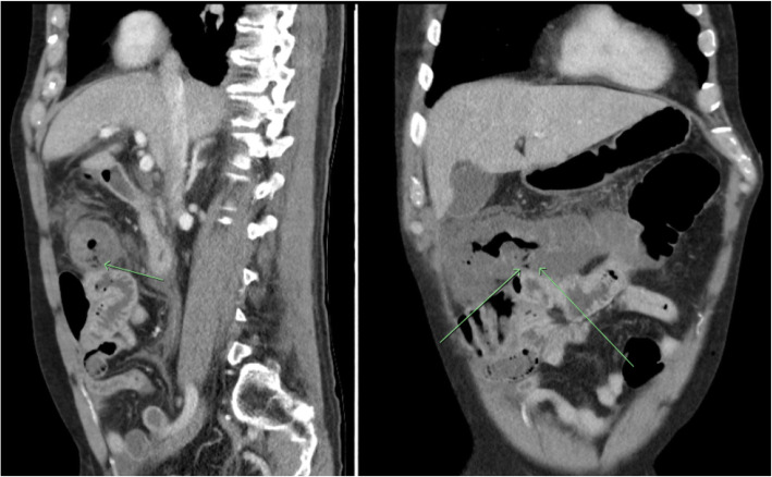 Fig. 1