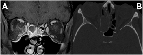 Figure
                                3.
