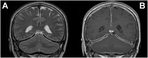 Figure
                            2.