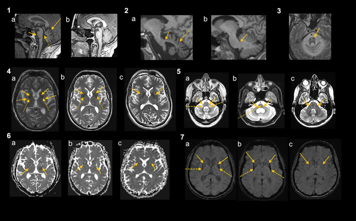 FIG. 1