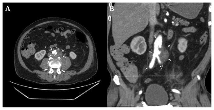 Fig. 1