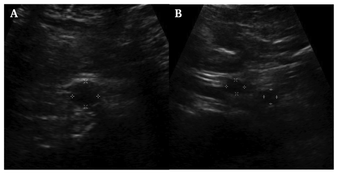 Fig. 3