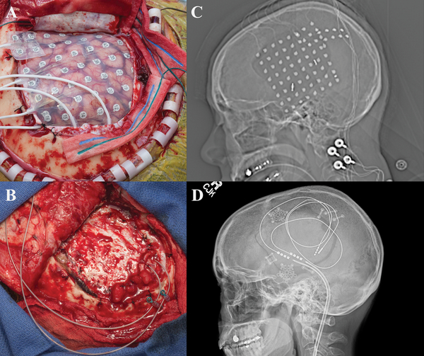 Figure 1: