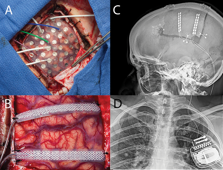 Figure 9: