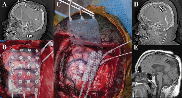 Figure 2: