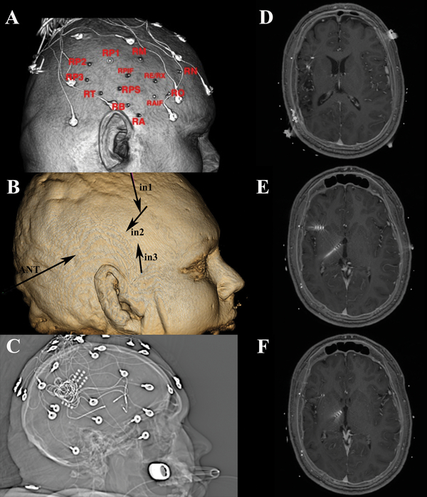 Figure 7: