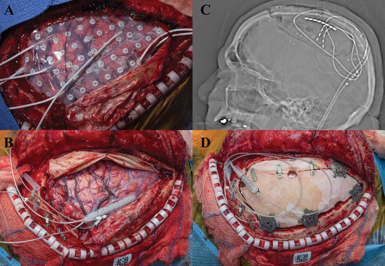 Figure 4: