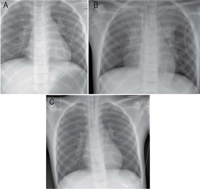 Figure 1A–C: