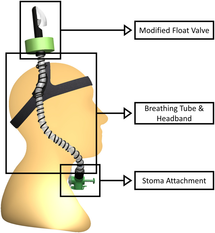 Fig 1