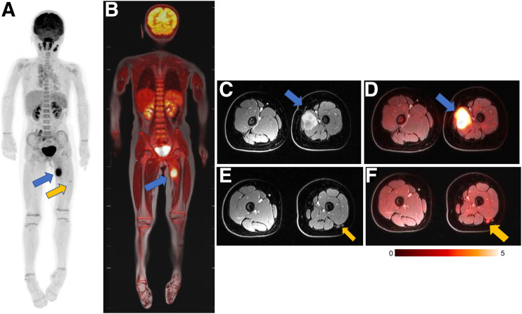 FIGURE 3.