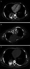 Fig. 4
