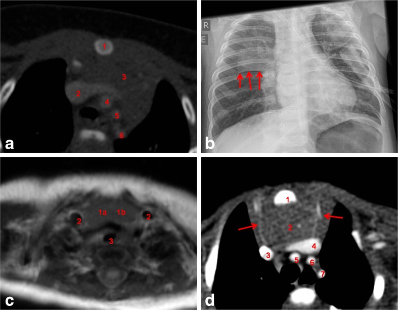 Fig. 12