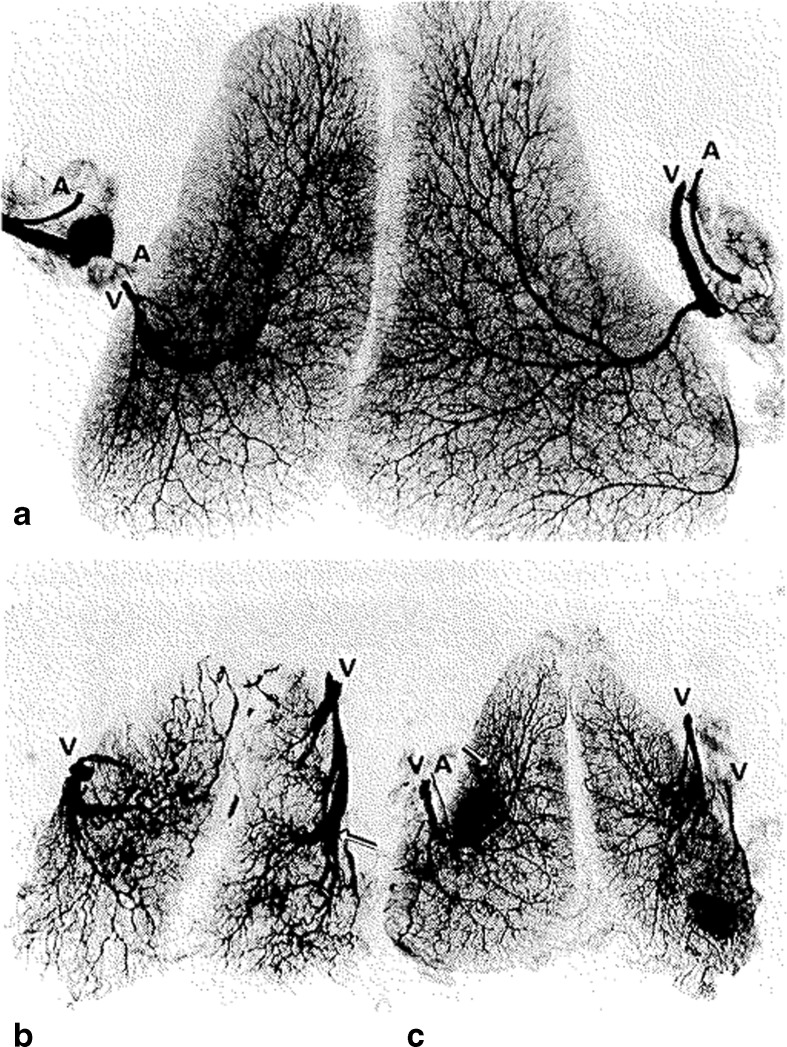 Fig. 11