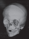 Figure 4D