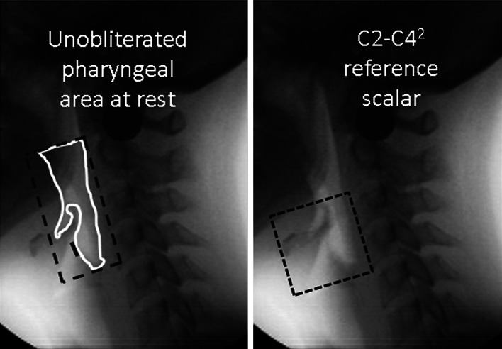 Fig. 1