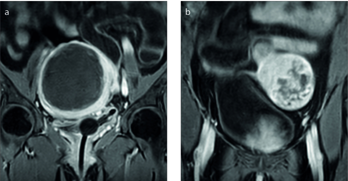 Figure 5. a, b