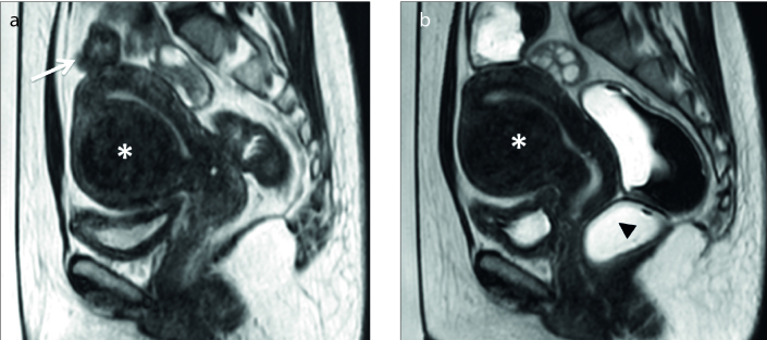 Figure 14. a, b