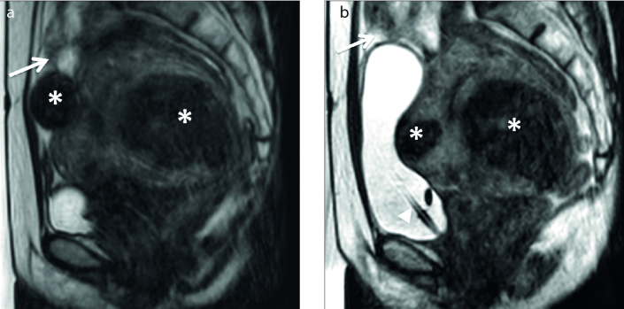 Figure 15. a, b