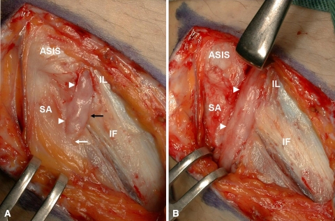 Fig. 1A–B