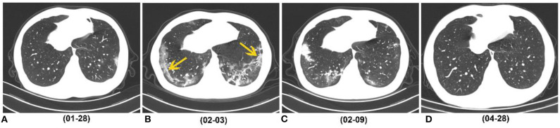 Figure 5