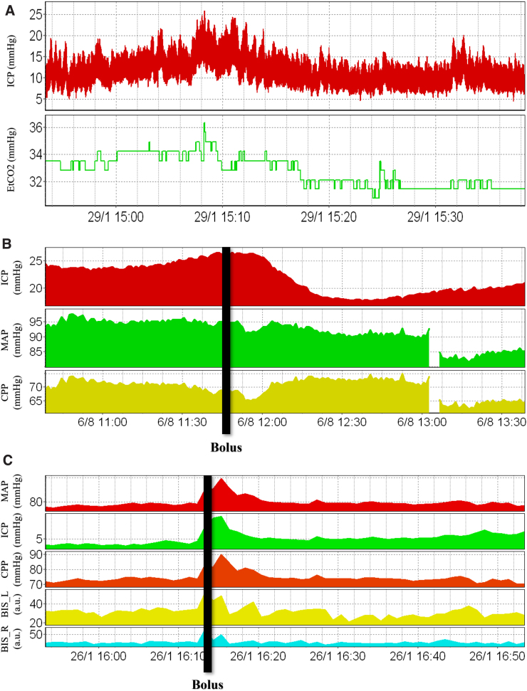 FIG. 2.