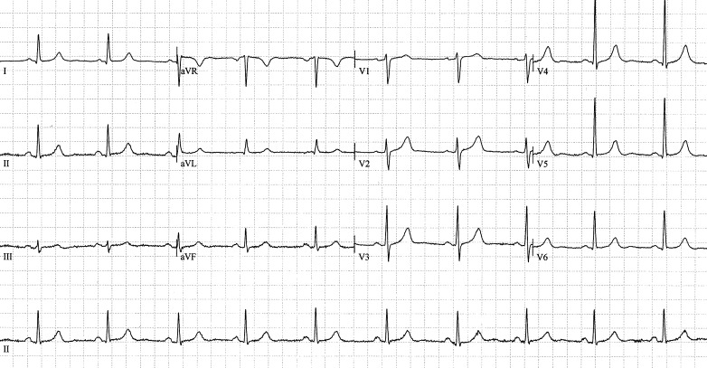 Fig. 3