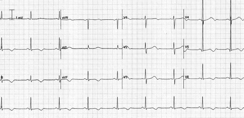 Fig. 2