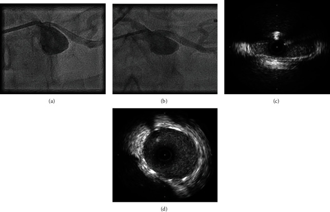 Figure 4