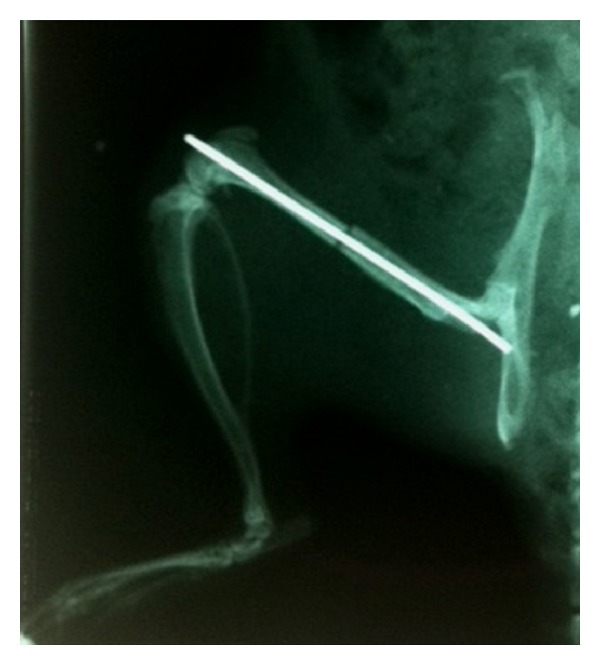 Figure 1