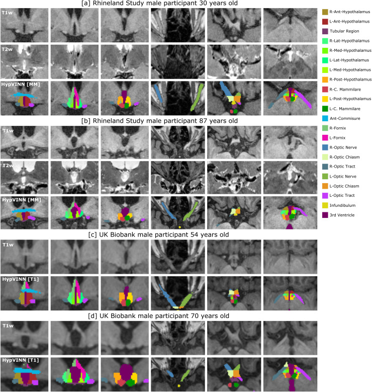 Fig. 9.