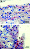 [Table/Fig-2a,b]: