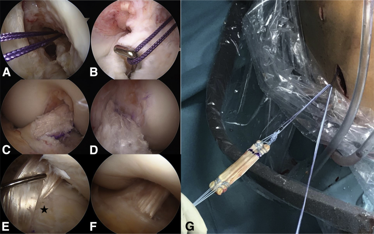 Fig 13