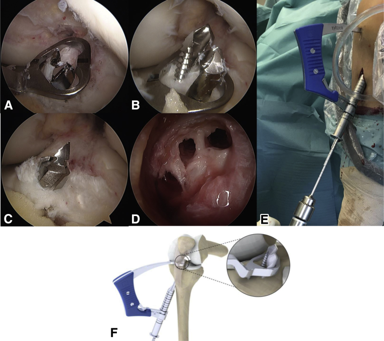 Fig 11